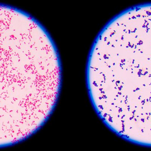 MUESTRA HIST. TINCION GRAM COCCUS NEGATIVO SIWAY UN
