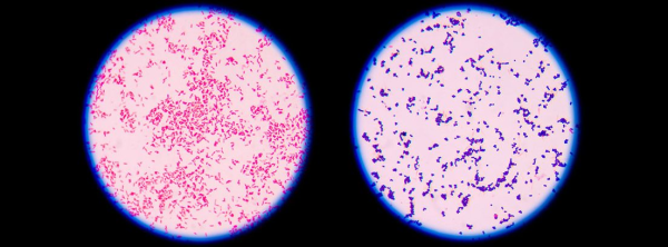 MUESTRA HIST. TINCION GRAM COCCUS NEGATIVO SIWAY UN