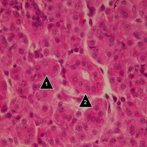 MUESTRA HIST. GLANDULA PAROTID SIWAY UN