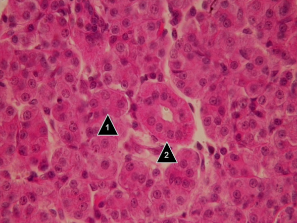 MUESTRA HIST. GLANDULA PAROTID SIWAY UN