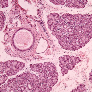 MUESTRA HIST. GLANDULA SUBLINGUAL SIWAY UN