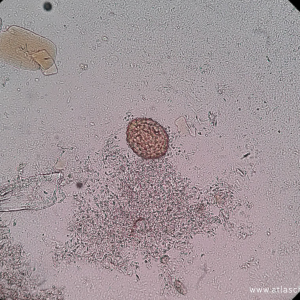 MUESTRA HIST HUEVO ASCARIS LUMBRICOIDES SIWAY UN