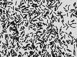 MUESTRA HIST. CLOSTRIDIUM PERFRINGENS SIWAY UN