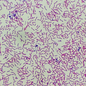 MUESTRA HIST. TINCION GRAM PARA E. COLI SIWAY UN