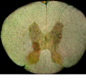 MUESTRA HIST. MEDULA ESPINAL DE CONEJO SIWAY UN