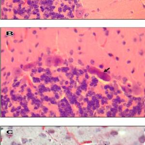 MUESTRA HIST. SECCION CEREBELO CELLULA PURKINJE SIWAY UN