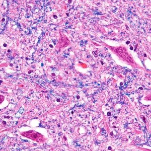 MUESTRA HIST. NEURONA MOTORA SIWAY UN