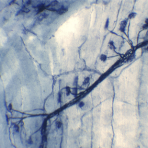 MUESTRA HIST. TERMINACION NERVIO MOTOR DE CONEJO SIWAY UN