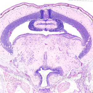 MUESTRA HIST. SECCION CEREBRO SIWAY UN