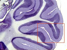 MUESTRA HIST. SECCION CEREBELO SIWAY UN