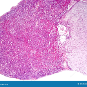 MUESTRA HIST. SECCION PITUITARIA SIWAY UN