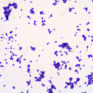 MUESTRA HIST. TINCION GRAM COCCUS POSITIVO SIWAY UN