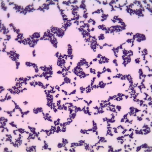 MUESTRA HIST. STAPHYLOCOCCUS SIWAY UN