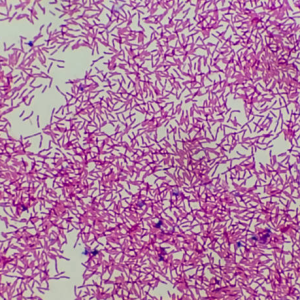 MUESTRA HIST. E. COLI SIWAY UN