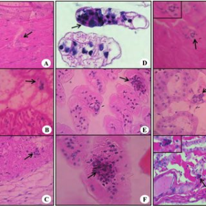MUESTRAS HISTOLOGICAS 10UN KONUS 04877